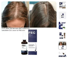 Hair Growth Spray