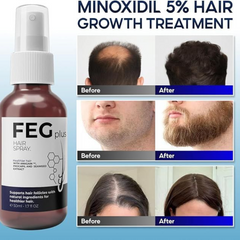 Hair Growth Spray PLUS